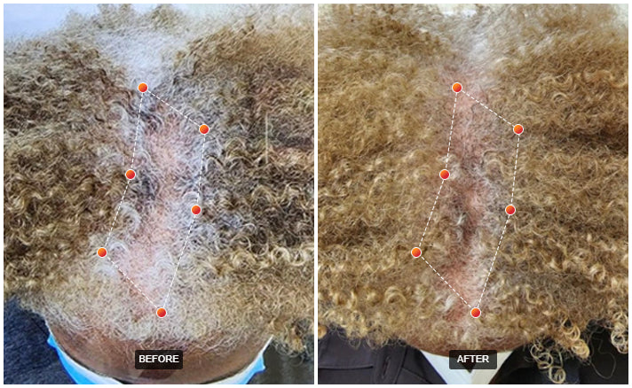 REVIAN RED Hair Growth Cap Dermatologist-Recommended Red Light Therapy for Hair Loss & Thinning Exclusive Pricing $1,500