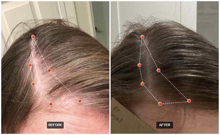 REVIAN RED Hair Growth Cap Dermatologist-Recommended Red Light Therapy for Hair Loss & Thinning Exclusive Pricing $1,500